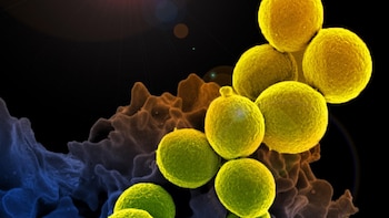 In this electron micrograph, a white blood cell is eaten by an antibiotic-resistant bacteria called methicillin-resistant Staphylococcus aureus, or MRSA.  CREDIT (Photo courtesy of the National Institute of Allergy and Infectious Diseases)