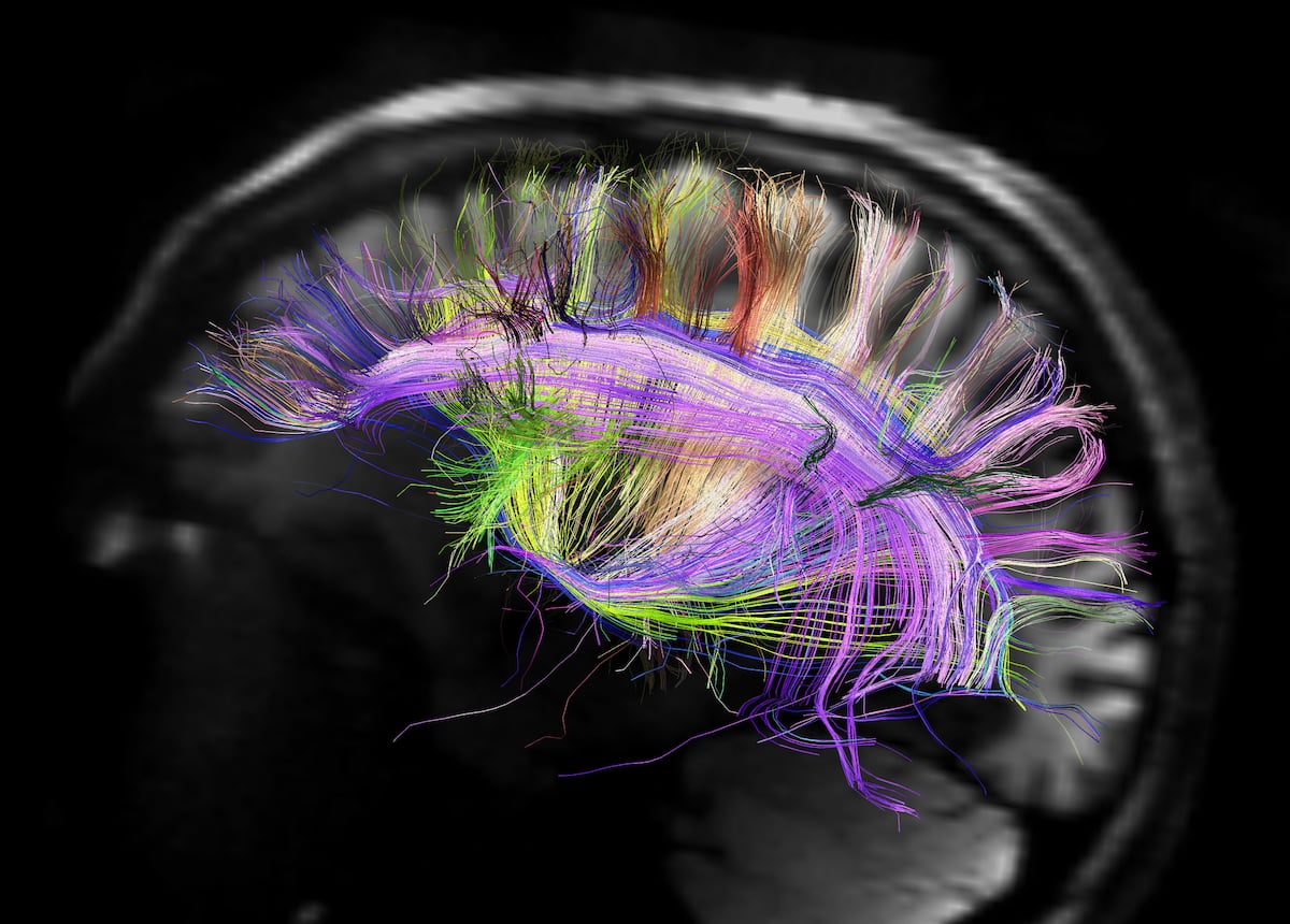 Pavlov saw it before anyone else: this is how emotions kidnap us | Health and well-being